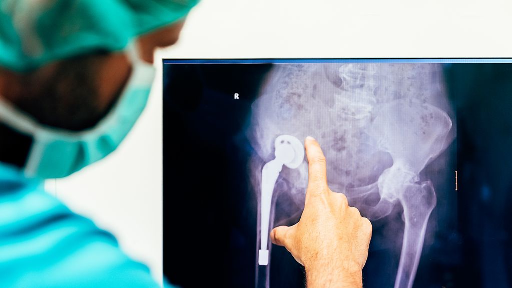 Ein in grüner Uniform mit Mundschutz bekleideter Arzt zeigt mit seinem rechten Zeigefinger auf ein Röntgenbild von einer künstlichen Hüfte.
