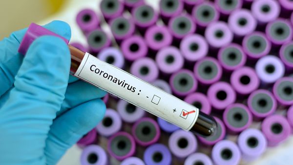 Blutproberöhrchen mit Aufschriftt Coronavirus positiv