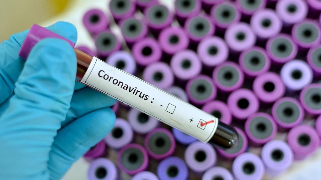 A hand in a latex glove holds a brown tube labelled “Coronavirus”.