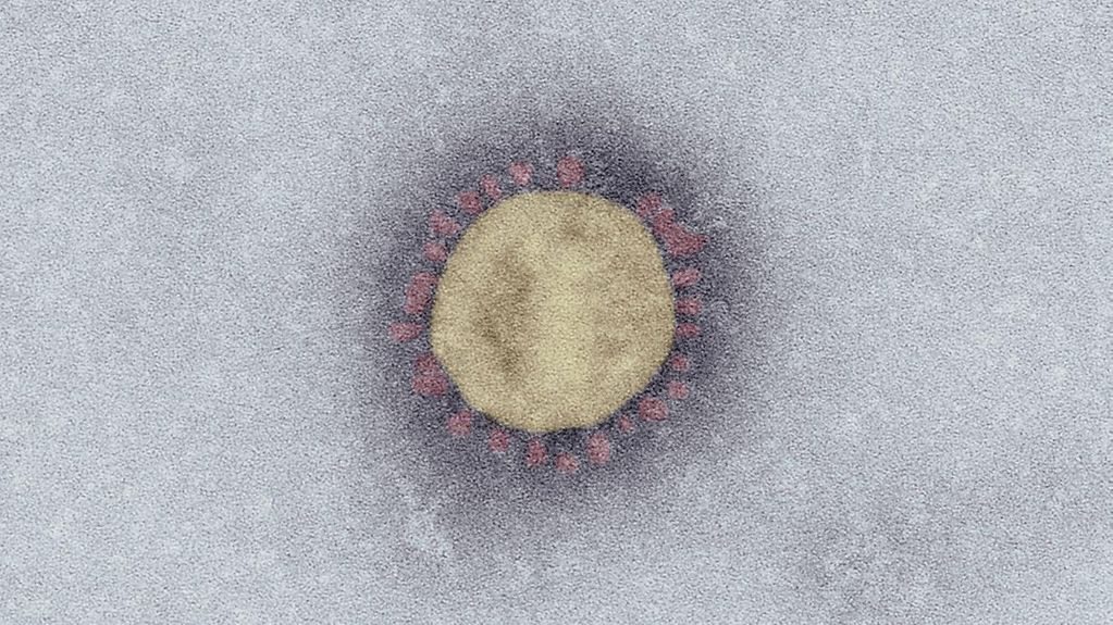 Das Corona-Virus in vielfacher Vergrößerung