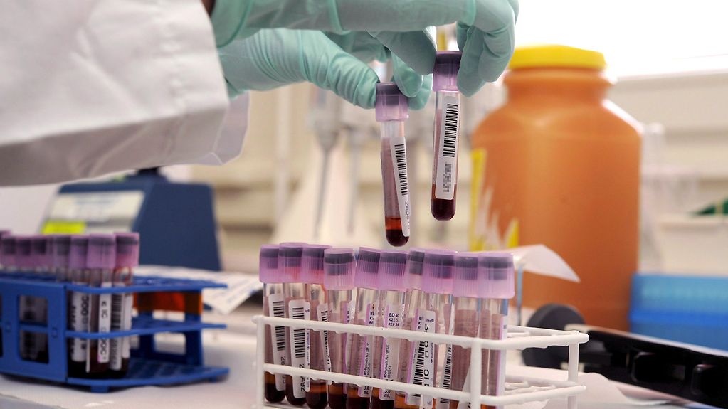 In einem Labor werden Blutproben in Reagenzgläsern untersucht.