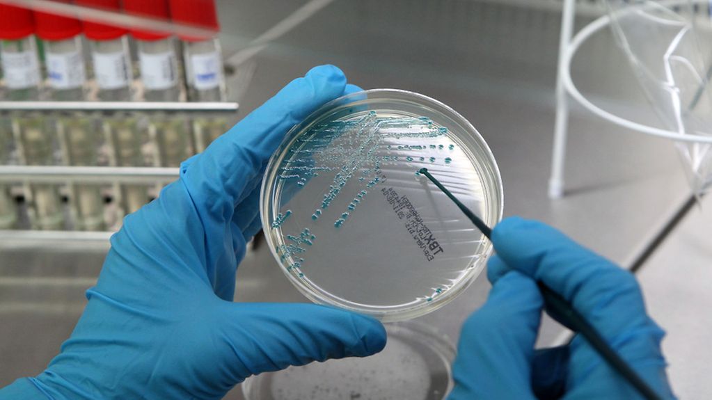 Bacteria culture in a Petri dish