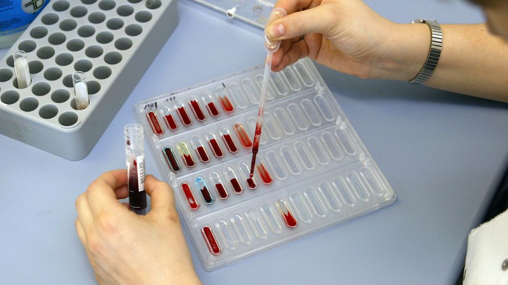Bluttests in einem medizinischen Labor
